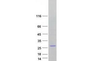 Validation with Western Blot