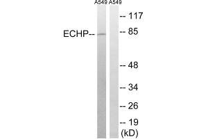 Western blot analysis of extracts from A549 cells, using EHHADH antibody. (EHHADH anticorps  (Internal Region))