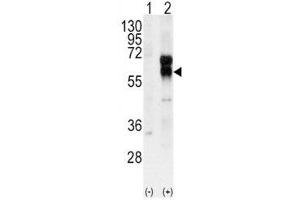 Western blot analysis of ALK1 antibody and 293 cell lysate (2 ug/lane) either nontransfected (Lane 1) or transiently transfected with the ACVRL1 gene (2).