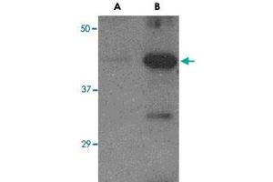 Western blot analysis of (A) 5 ng and (B) 25 ng of recombinant Hemagglutinin with Avian Influenza Hemagglutinin polyclonal antibody  at 1 ug/mL . (Hemagglutinin anticorps  (N-Term))
