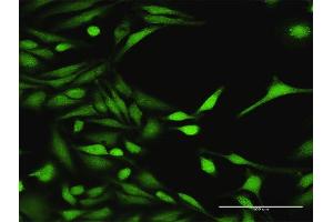 Immunofluorescence of purified MaxPab antibody to MAP3K7 on HeLa cell.