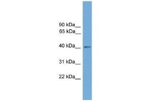Human HeLa; WB Suggested Anti-ZDHHC18 Antibody Titration: 0. (ZDHHC18 anticorps  (Middle Region))