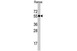 Western blot analysis of CDC6 polyclonal antibody  in Ramos cell lysate (35 ug/lane). (CDC6 anticorps  (N-Term))