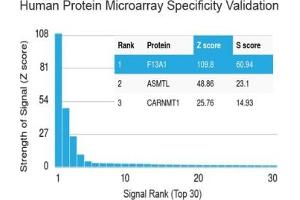 Analysis of HuProt(TM) microarray containing more than 19,000 full-length human proteins using Factor XIIIa antibody (clone F13A1/1683). (F13A1 anticorps  (AA 46-181))