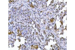 IHC analysis of FIP1L1 using anti-FIP1L1 antibody (ABIN7600761). (FIP1L1 anticorps  (AA 23-558))