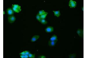 Immunofluorescence staining of HepG2 cells with ABIN7127496 at 1:27, counter-stained with DAPI.