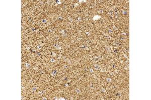 anti-Bridging Integrator 1 (BIN1) (AA 45-593) antibody