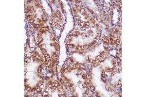 Immunohistochemistry of paraffin-embedded Rat kidney using PIGM Rabbit pAb (ABIN7269294) at dilution of 1:100 (40x lens).