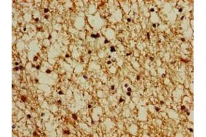 Immunohistochemistry of paraffin-embedded human brain tissue using ABIN7164927 at dilution of 1:100 (PSMG1 anticorps  (AA 91-200))
