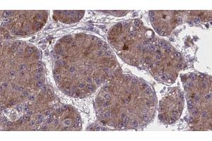 anti-RhoA,B,C antibody