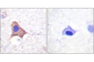 Immunohistochemistry analysis of paraffin-embedded human brain, using CD71/TfR (Phospho-Ser24) Antibody. (Transferrin Receptor anticorps  (pSer24))
