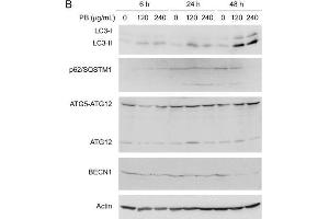 PB induces autophagy but blocks autophagosome trafficking and autophagosome-lysosome fusion in Hep3B cells.