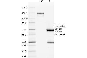 SDS-PAGE Analysis Purified p53 Mouse Monoclonal Antibody (DO-1).