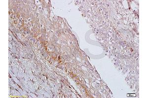 Formalin-fixed and paraffin embedded rat ovary tissue labeled with Anti-AGPAT4 Polyclonal Antibody, Unconjugated (ABIN708671) at 1:200 followed by conjugation to the secondary antibody, (SP-0023), and DAB staining (AGPAT4 anticorps  (AA 231-330))