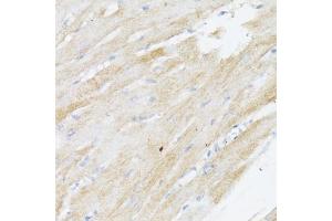 Immunohistochemistry of paraffin-embedded rat heart using BMPR2 antibody (ABIN7265906) at dilution of 1:100 (40x lens).