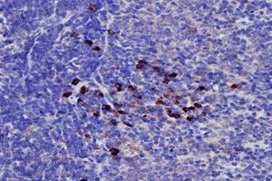 Immunohistochemistry analysis of paraffin-embedded rat spleen using,PRELID1 (ABIN7075173) at dilution of 1: 4000 (PRELID1 anticorps)