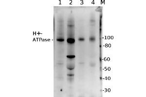 5 µg of total protein from (1) Zea mays lwhole cell, extracted with Protein Extration Buffer, PEB, (2) Hordeum vulgare leaf extracted with PEB, (3) Spinacia oleracea total cell extracted with PEB, (4) Arabidopsis thaliana  were separated on  4-12% NuPage (Invitrogen) LDS-PAGE and blotted 1h to PVDF. (ATP6AP1 anticorps)