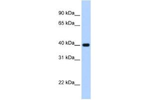 WB Suggested Anti-ZNF187 Antibody Titration:  2. (ZNF187 anticorps  (C-Term))