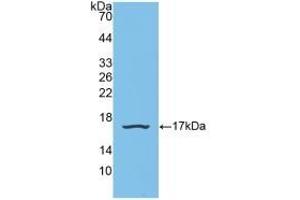 Detection of Recombinant SNRPD1, Human using Polyclonal Antibody to Small Nuclear Ribonucleoprotein Polypeptide D1 (SNRPD1) (SNRPD1 anticorps  (AA 1-119))