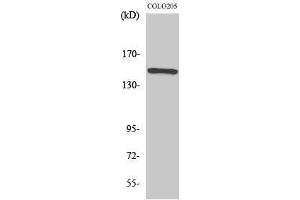 Western Blotting (WB) image for anti-RAD50 Homolog (S. Cerevisiae) (RAD50) (Internal Region) antibody (ABIN3186656) (RAD50 anticorps  (Internal Region))