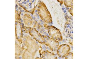 Immunohistochemistry of paraffin-embedded mouse kidney using CDC42 antibody at dilution of 1:200 (x400 lens) (CDC42 anticorps)
