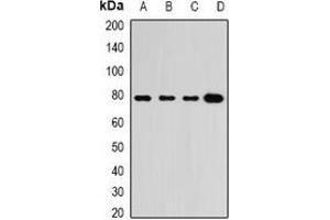 Western blot analysis of GRP3 expression in BT474 (A), A549 (B), mouse heart (C), mouse lung (D) whole cell lysates. (RASGRP3 anticorps)