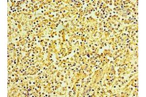 Immunohistochemistry of paraffin-embedded human spleen tissue using ABIN7145839 at dilution of 1:100 (KCTD15 anticorps  (AA 1-234))