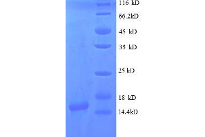 SDS-PAGE (SDS) image for gamma-Interferon-Induced Monokine (CXCL9) (AA 22-126) protein (His tag) (ABIN5712670)
