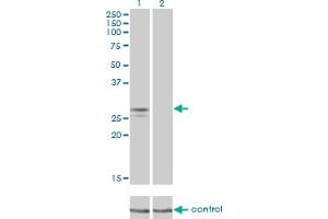 Western blot analysis of NDUFS3 over-expressed 293 cell line, cotransfected with NDUFS3 Validated Chimera RNAi (Lane 2) or non-transfected control (Lane 1).