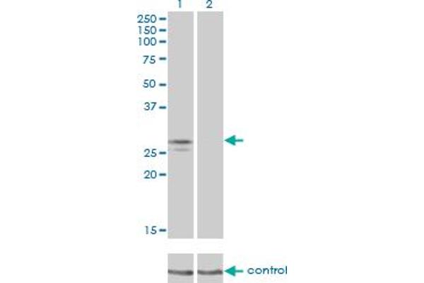 NDUFS3 anticorps  (AA 1-264)