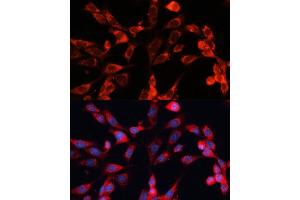 Immunofluorescence analysis of NIH-3T3 cells using MRPS28 Polyclonal Antibody (ABIN6133074, ABIN6144041, ABIN6144042 and ABIN6220731) at dilution of 1:100 (40x lens).