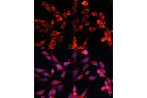 Immunofluorescence analysis of NIH-3T3 cells using MRPS28 Polyclonal Antibody (ABIN6133074, ABIN6144041, ABIN6144042 and ABIN6220731) at dilution of 1:100 (40x lens). (MRPS28 anticorps  (AA 1-187))