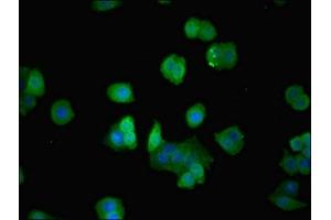 Immunofluorescent analysis of PC-3 cells using ABIN7143089 at dilution of 1:100 and Alexa Fluor 488-congugated AffiniPure Goat Anti-Rabbit IgG(H+L) (ARPC3 anticorps  (AA 2-175))