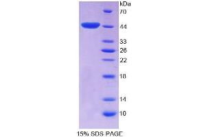 SDS-PAGE analysis of Rat EP300 Protein. (p300 Protéine)