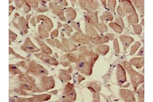 Immunohistochemistry of paraffin-embedded human heart tissue using ABIN7170088 at dilution of 1:100 (SLC12A7 anticorps  (AA 11-117))