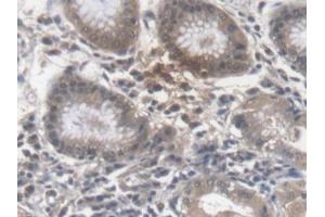 Detection of EPO in Human Stomach Tissue using Monoclonal Antibody to Erythropoietin (EPO)