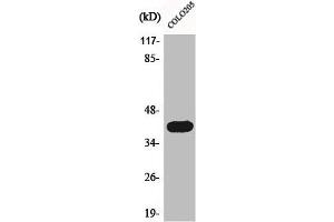 Western Blot analysis of COLO205 cells using Actin α3 Polyclonal Antibody