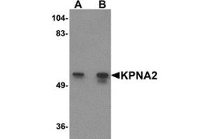 Western blot analysis of KPNA2 in rat heart tissue lysate with KPNA2 antibody at (A) 1 and (B) 2 μg/ml. (KPNA2 anticorps  (N-Term))