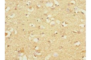 Immunohistochemistry of paraffin-embedded human brain tissue using ABIN7163588 at dilution of 1:100