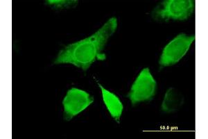Immunofluorescence of purified MaxPab antibody to GEMIN6 on HeLa cell. (GEMIN6 anticorps  (AA 1-167))
