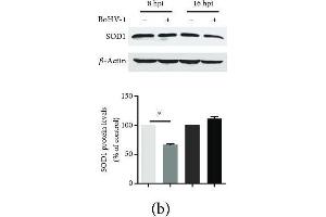 The effects of BoHV-1 infection on the gene expression of antioxidant enzymes. (SOD1 anticorps  (AA 1-154))