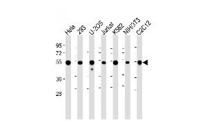 All lanes : Anti-VIME Antibody at 1:2000 dilution Lane 1: Hela whole cell lysate Lane 2: 293 whole cell lysate Lane 3: U-2OS whole cell lysate Lane 4: Jurkat whole cell lysate Lane 5: K562 whole cell lysate Lane 6: NIH/3T3 whole cell lysate Lane 7: C2C12 whole cell lysate Lysates/proteins at 20 μg per lane.