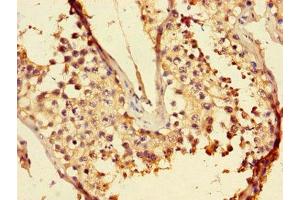 Immunohistochemistry of paraffin-embedded human testis tissue using ABIN7158030 at dilution of 1:100 (LZTFL1 anticorps  (AA 116-299))
