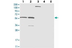 Western blot analysis of Lane 1: RT-4, Lane 2: U-251 MG, Lane 3: Human Plasma, Lane 4: Liver, Lane 5: Tonsil with ZNF250 polyclonal antibody  at 1:250-1:500 dilution. (ZNF250 anticorps)