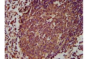 IHC image of ABIN7164473 diluted at 1:300 and staining in paraffin-embedded human lymph node tissue performed on a Leica BondTM system.