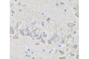 Immunohistochemistry of paraffin-embedded Mouse brain using RhoA Polyclonal Antibody at dilution of 1:100 (40x lens). (RHOA anticorps)