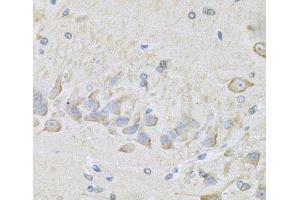 Immunohistochemistry of paraffin-embedded Mouse brain using RhoA Polyclonal Antibody at dilution of 1:100 (40x lens). (RHOA anticorps)