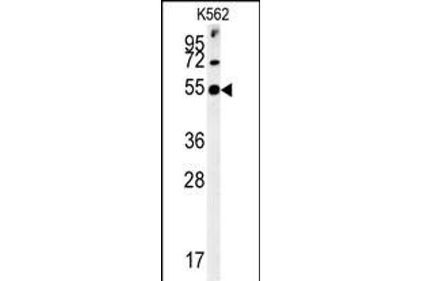 SYT13 anticorps  (N-Term)