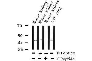 Western blot analysis of Phospho-c-Jun (Ser73) expression in various lysates (C-JUN anticorps  (pSer73))