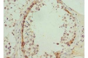 Immunohistochemistry of paraffin-embedded human testis tissue using ABIN7144880 at dilution of 1:100